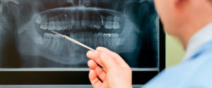 In unserer Zahnarzt-Praxis in Mutlangen bieten wir neuste Behandlungsmethoden rund um Ihre Zähne