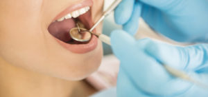 Prophylaxe in der Zahnarztpraxis von Frau Dr. Kümmel in Mutlangen bei Schwäbisch Gmünd